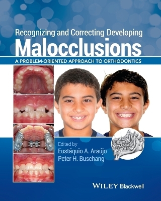 Recognizing and Correcting Developing Malocclusions – A Problem–Oriented Approach to Orthodontics - E Araújo