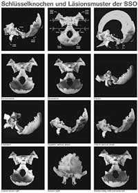 CSO - CranioSacralOsteopathie (3 Poster in Rolle)