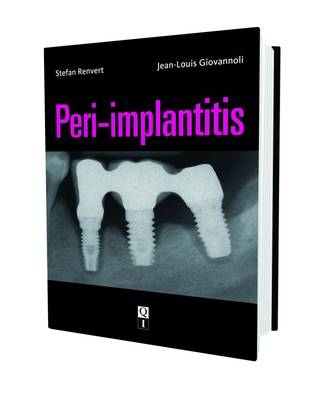 Peri-implantitis