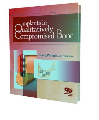 Implants in Qualitatively Compromised Bone - 