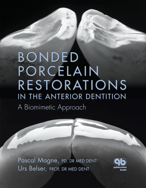 Bonded Porcelain Restorations in the Anterior Dentition - Magne Pascal, Urs Belser