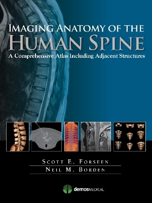 Imaging Anatomy of the Human Spine - Scott E. Forseen, Neil M. Borden