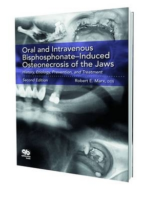 Oral & Intravenous Bisphosphonate-induced Osteonecrosis of the Jaws