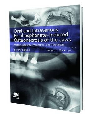Oral & Intravenous Bisphosphonate-induced Osteonecrosis of the Jaws - Robert E. Marx