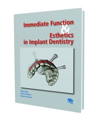Immediate Function and Esthetic in Implant Dentistry