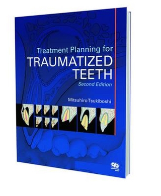 Treatment Planning for Traumatized Teeth