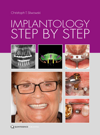 Implantology Step by Step