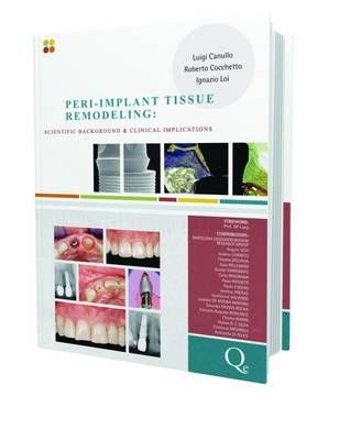 Peri-implant Tissue Remodeling - Luigi Canullo, Ignazio Loi, Robert Cocchetto