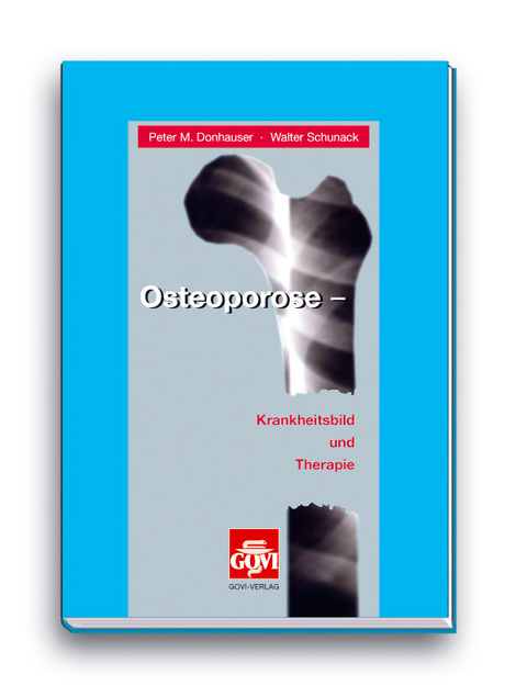 Osteoporose - Peter M. Donhauser, Walter Schunack