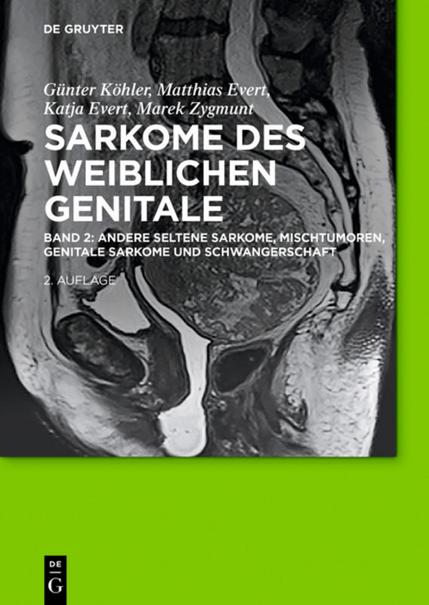 Sarkome des weiblichen Genitale - G&uuml;nther K&ouml;hler, Matthias Evert, Katja Evert, Marek Zygmunt