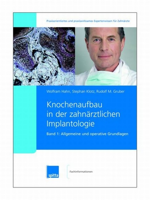Knochenaufbau in der zahn&auml;rztlichen Implantologie. 2007/2008. Band 1 + 2 / Allgemeine und operative Grundlagen - Wolfram Hahn, Stephan Klotz, Rudolf M Gruber