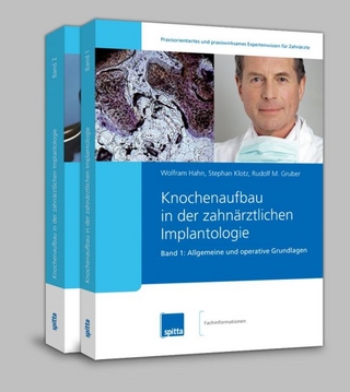 Knochenaufbau in der zahnärztlichen Implantologie. 2007/2008. Band 1 + 2 / Knochenaufbau in der zahnärztlichen Implantologie – Set Band 1 + Band 2