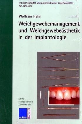 Weichgewebemanagement und Weichgewebeästhetik in der Implantologie
