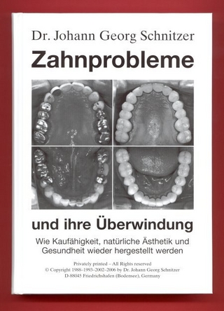 Zahnprobleme und ihre Überwindung