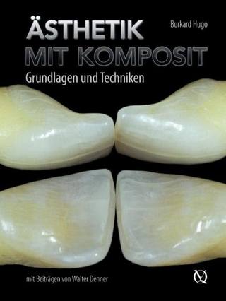 Ästhetik mit Komposit