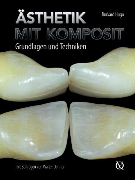 &Auml;sthetik mit Komposit - Burkard Hugo