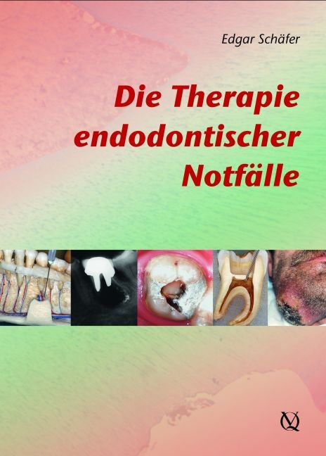Die Therapie endodontischer Notf&auml;lle - Edgar Sch&auml;fer