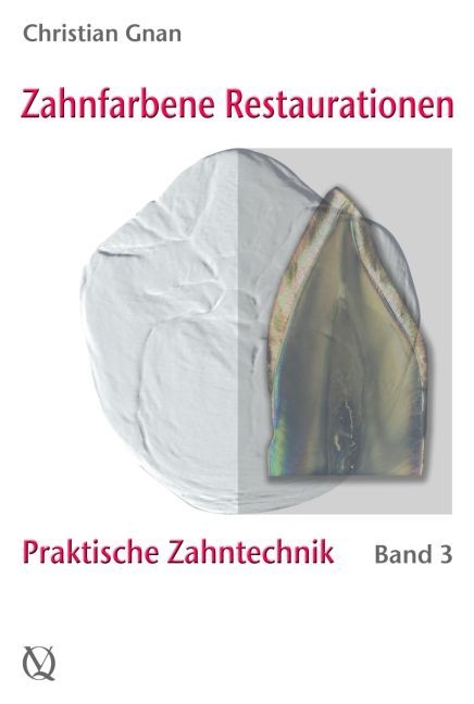 Zahnfarbene Restaurationen - Christian Gnan