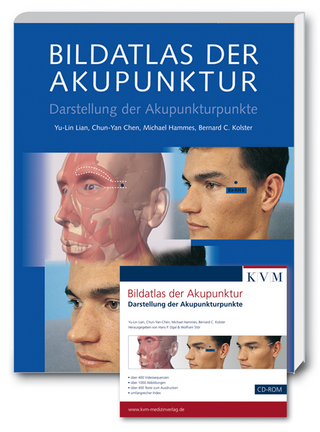 Bildatlas der Akupunktur + CD ROM