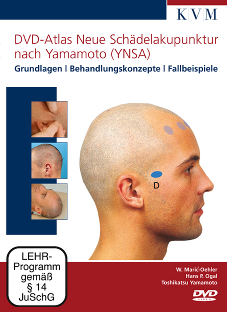 DVD-Atlas Neue Schädelakupunktur nach Yamamoto (YNSA) - Walburg Maric-Oehler, Hans P Ogal
