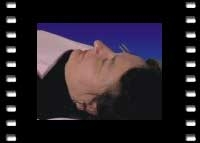 Akupunkturbehandlung vom Somatotop