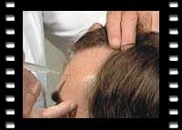 Einfache Neuraltherapie in der t&auml;glichen Praxis - Otto Bergsmann