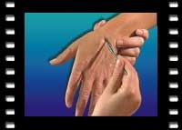 Su Jok-Akupunktur - Larissa Finken