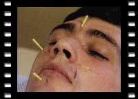 Raucherentw&ouml;hnung /Adipositas mit Akupunktur - Gerhard Jedicke