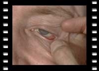 Biologische Medizin in der Augenheilkunde