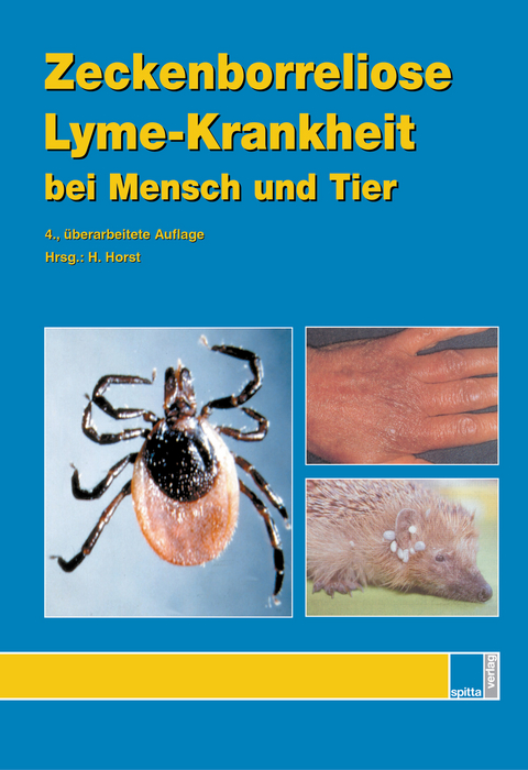 Zeckenborreliose &ndash; Lyme-Krankheit bei Mensch und Tier - Hans Horst, Arndt Liebisch