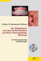 Von Totalprothesen nach dem All-Oral-Verfahren zum Micro&copy;-Plant-gest&uuml;tzten Zahnersatz - Norbert M&uuml;ller, Thomas Morneburg, Manfred Hofmann