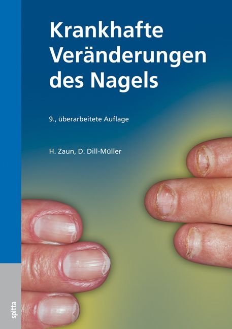 Krankhafte Ver&auml;nderungen des Nagels - Hans O Zaun, Dorothee Dill-M&uuml;ller