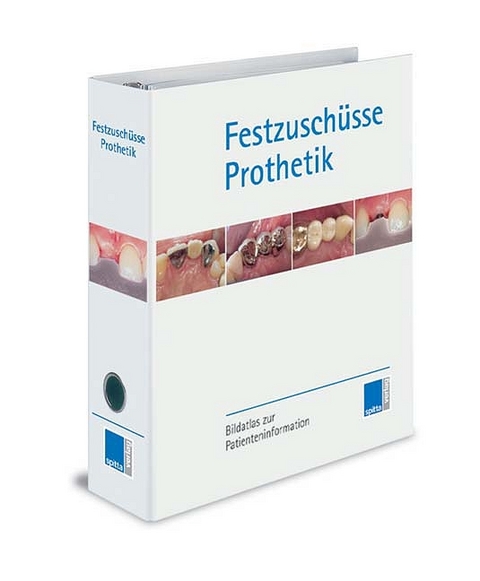 Festzusch&uuml;sse Prothetik - 