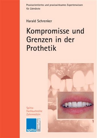 Kompromisse und Grenzen in der Prothetik