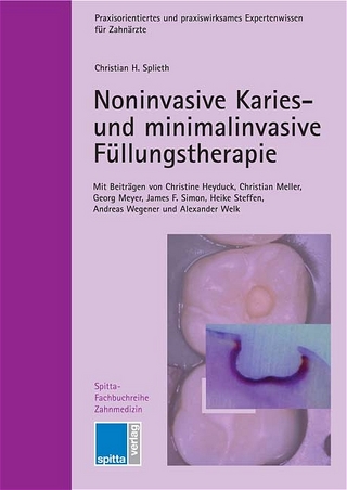 Noninvasive Karies- und minimalinvasive Füllungstherapie