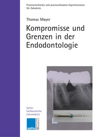 Kompromisse und Grenzen in der Endodontologie