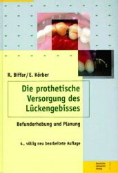 Die prothetische Versorgung des Lückengebisses