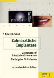 Zahnärztliche Implantate