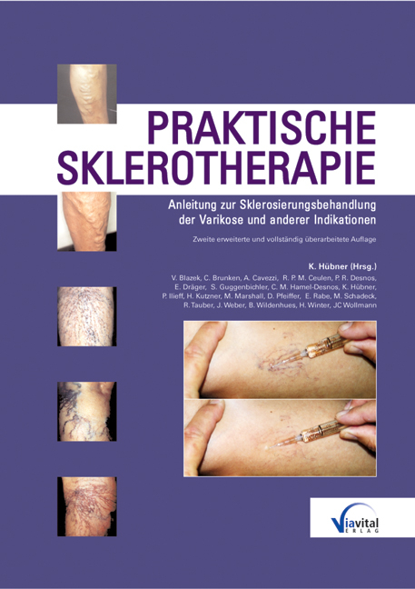 Praktische Sklerotherapie - 