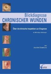 Blickdiagnose chronischer Wunden - Joachim Dissemond