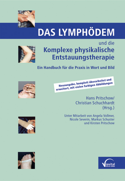 Das Lymph&ouml;dem und die Komplexe physikalische Entstauungstherapie - Angela Vollmer, Nicole Severin, Markus Schuster, Kirsten Pritschow