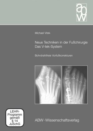 Neue Techniken in der Fu&szlig;chirurgie - Das V-tek-System - Michael Vitek