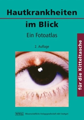 Hautkrankheiten im Blick