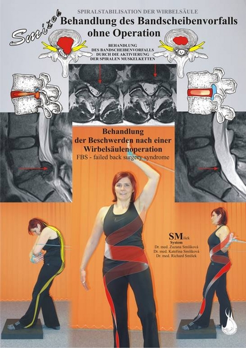 Behandlung des Bandscheibenvorfalls ohne Operation - Richard Sm&iacute;&scaron;ek, Katerina Sm&iacute;skov&aacute;, Zuzana Sm&iacute;skov&aacute;