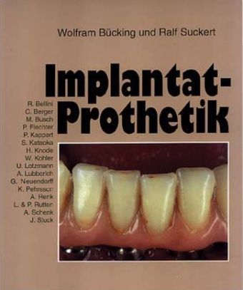Implantat-Prothetik - Wolfram B&uuml;cking, Ralf Suckert