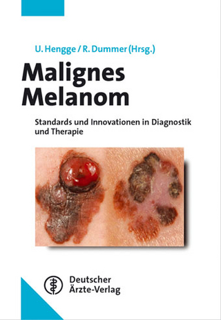 Malignes Melanom