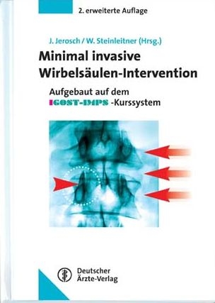 Minimal-Invasive Wirbels&auml;ulen-Intervention - 