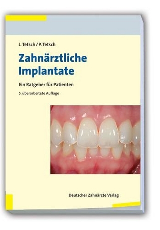 Zahnärztliche Implantate