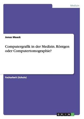 Computergrafik in der Medizin. Röntgen oder Computertomographie?