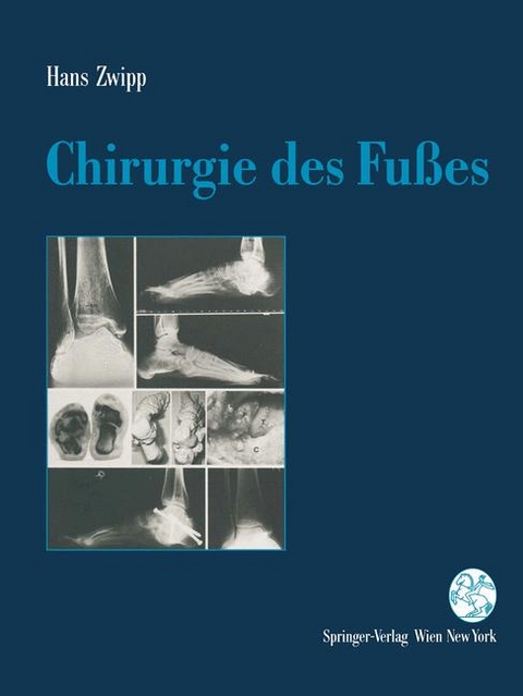 Chirurgie des Fu&szlig;es - Hans Zwipp